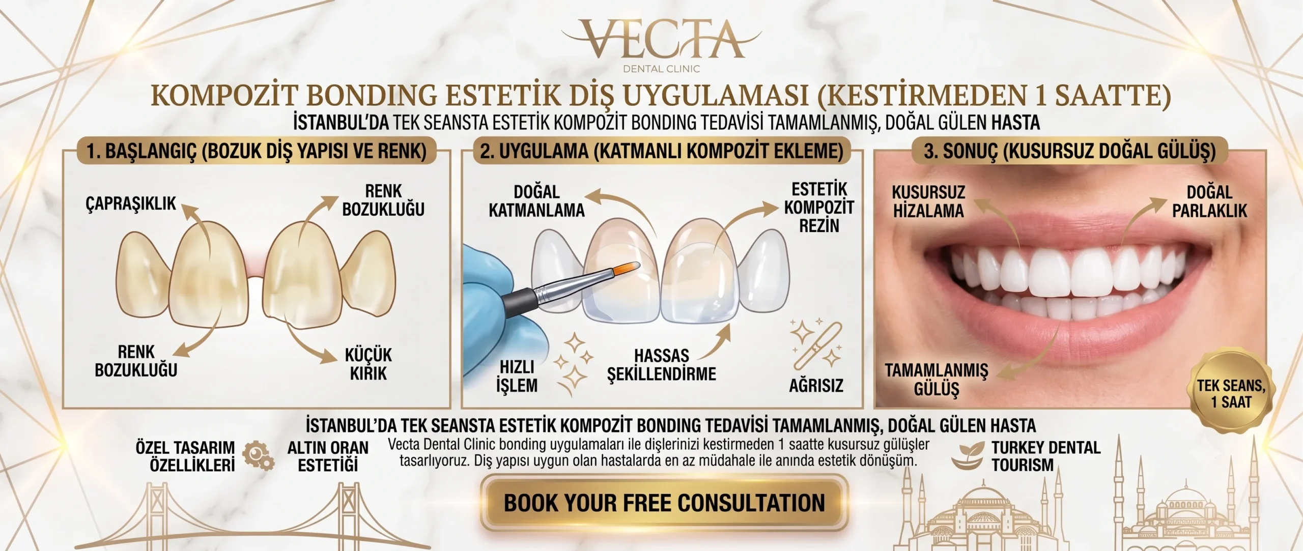 Bonding Estetik Kompozit İstanbul Vecta Dental