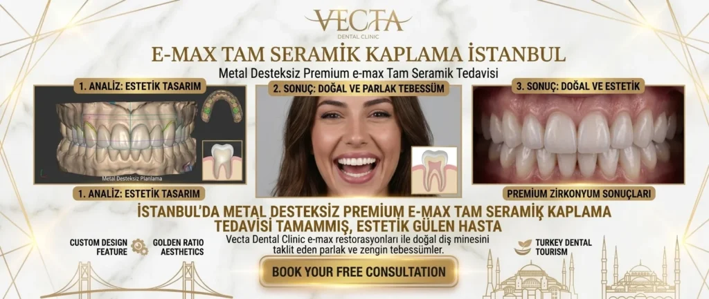 Emax Tam Seramik Kaplamalar İstanbul Vecta