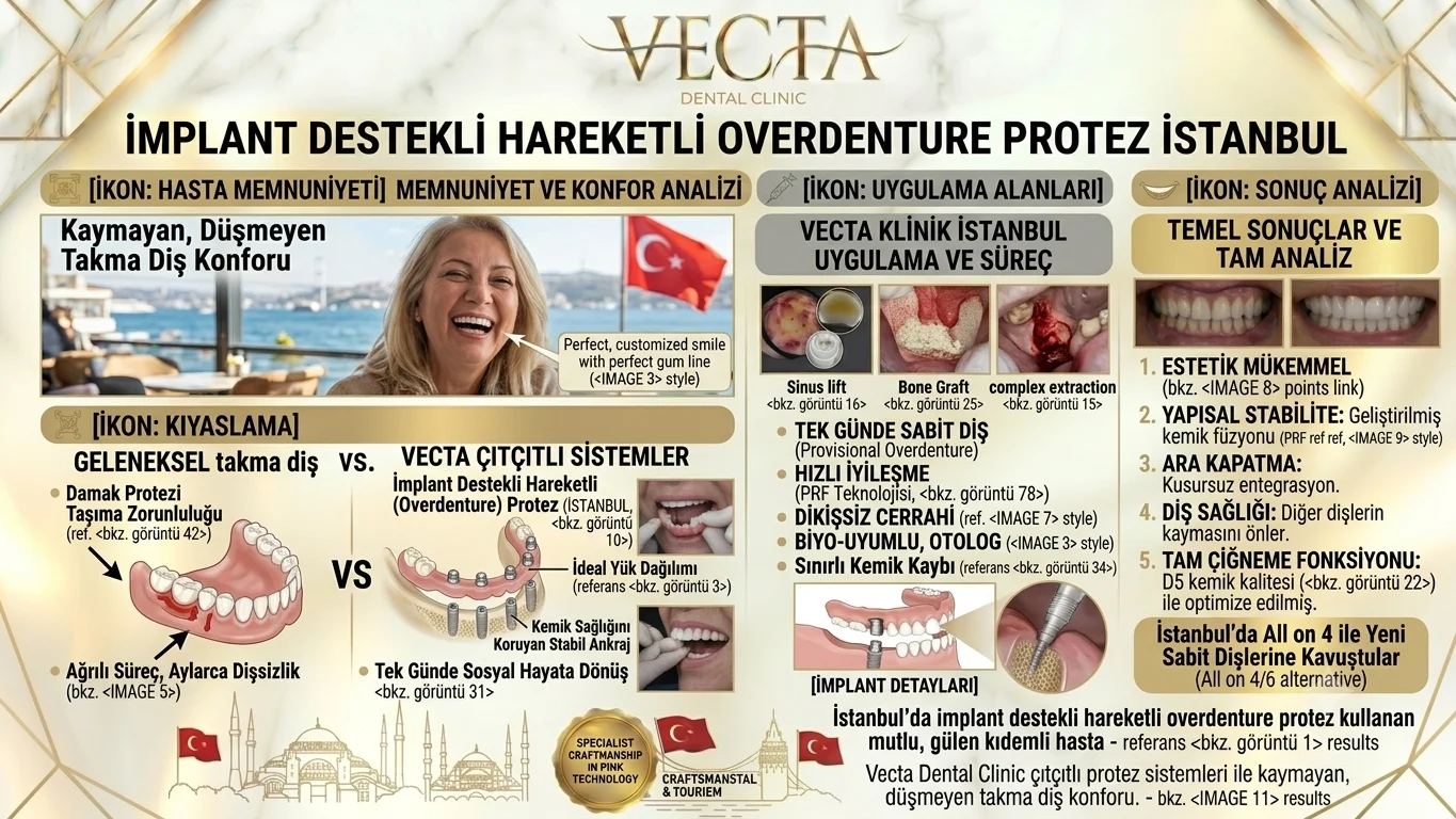 İmplant Destekli Hareketli Protez Overdenture İstanbul Vecta Dental Clinic
