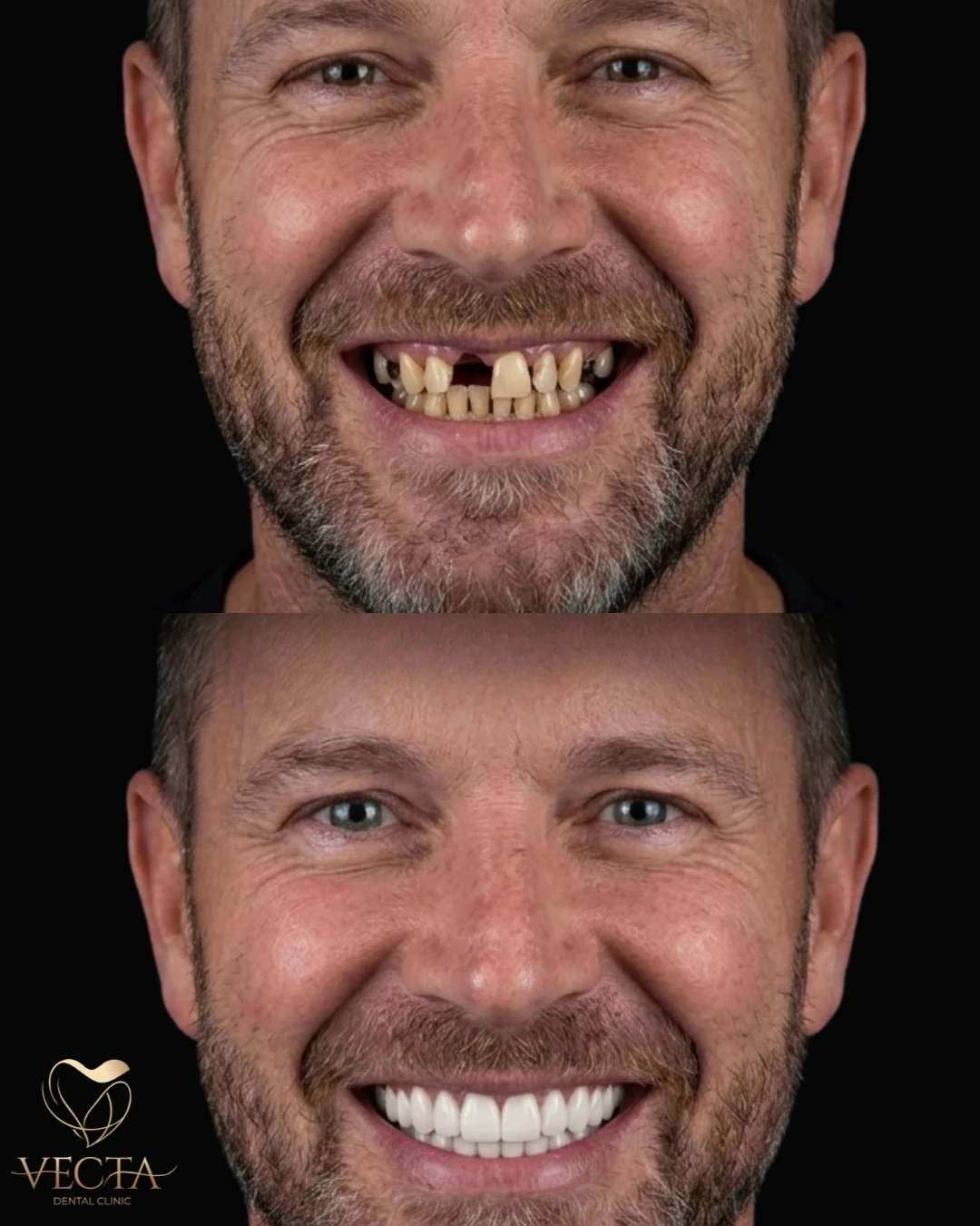 İstanbul Diş Kliniği | Vecta Dental Clinic