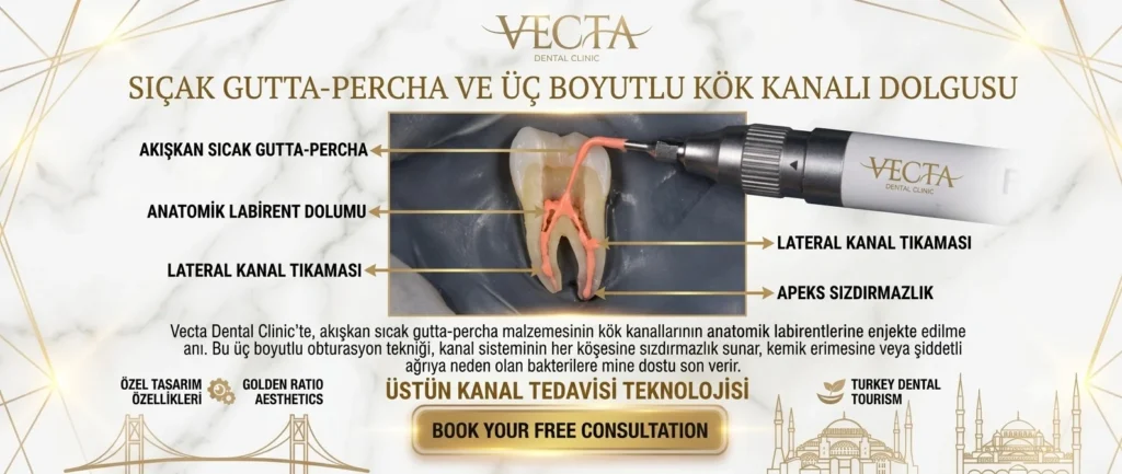 Sıcak Gutta Percha Üç Boyutlu Kök Kanalı Dolgusu