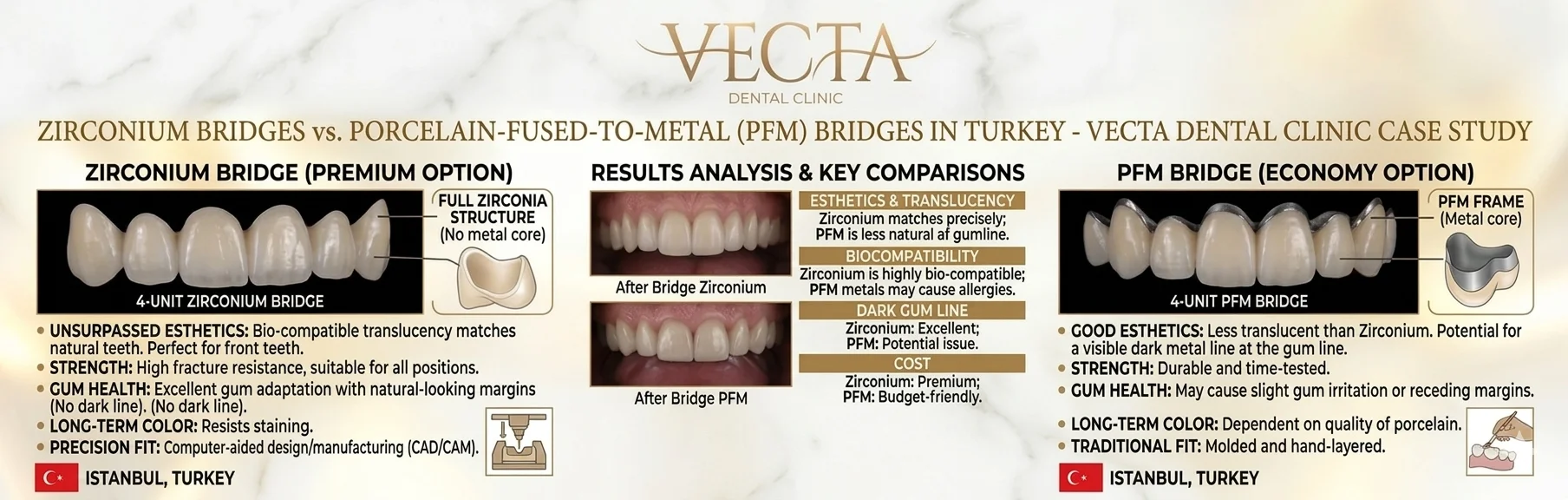 zirconium bridge vs porcelain fused metal turkey